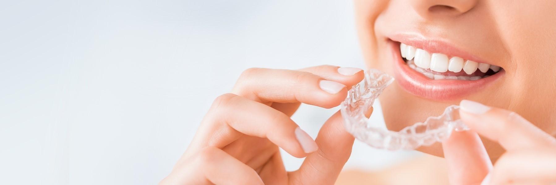 Cosmetic Orthodontics | Dentist