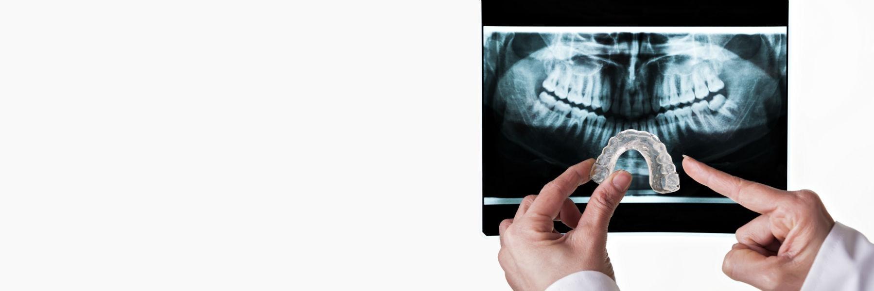 Nightguards and Athletic Mouthguards | Dentist